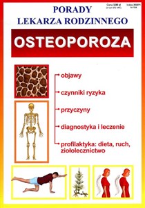Bild von Osteoporoza Porady Lekarza Rodzinnego