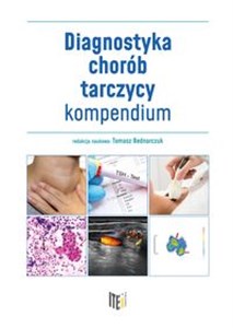 Bild von Diagnostyka chorób tarczycy kompendium