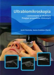 Bild von Ultrabiomikroskopia - zastosowanie w okulistyce Przegląd przypadków klinicznych