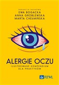 Polska książka : Alergie oc... - Ewa Bogacka, Anna Groblewska, Marta Chełmińska