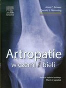 Zobacz : Artropatie... - Anne C. Brower, Donald J. Flemming