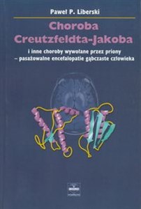 Obrazek Choroba Creutzfeldta-Jakoba I inne choroby wywołane przez priony - pasażowalne encefalopatie gąbczaste człowieka