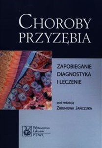 Bild von Choroby przyzębia Zapobieganie, diagnostyka i leczenie