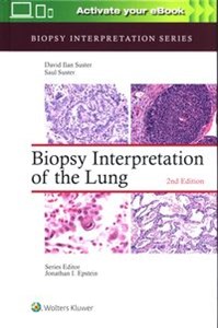 Bild von Biopsy Interpretation of the Lung Second edition