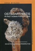 Osteoarthr... - Anna Myszka -  polnische Bücher