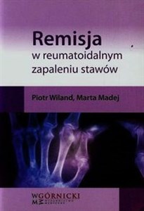 Obrazek Remisja w reumatoidalnym zapaleniu stawów