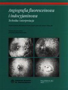 Obrazek Angiografia fluoresceinowa i indocyjaninowa Technika i interpretacja
