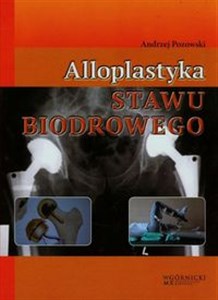 Obrazek Alloplastyka stawu biodrowego