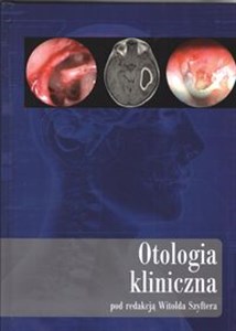 Bild von Otologia kliniczna