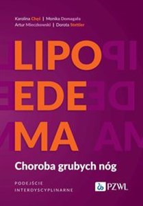 Obrazek Lipoedema Choroba grubych nóg. Podejście interdyscyplinarne