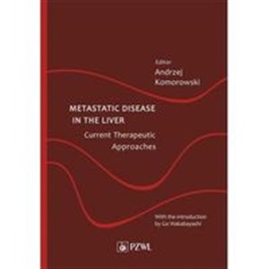 Bild von Metastatic Disease in the Liver Current Therapeutic Approaches