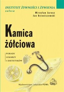 Bild von Kamica żółciowa