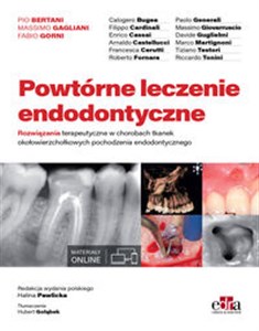 Obrazek Powtórne leczenie endodontyczne