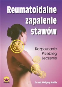 Bild von Reumatoidalne zapalenie stawów