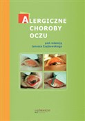 Alergiczne... - Ewa Bogacka, Janusz Czajkowski, Józef Małolepszy - Ksiegarnia w niemczech