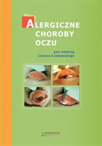 Obrazek Alergiczne choroby oczu