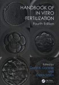 Obrazek Handbook of In Vitro Fertilization