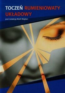 Obrazek Toczeń rumieniowaty układowy