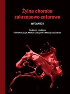 Obrazek Żylna choroba zakrzepowo-zatorowa