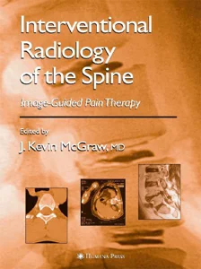 Obrazek INTERVENTIONAL RADIOLOGY OF THE SPINE