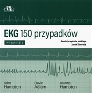 Obrazek EKG 150 przypadków