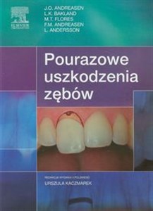 Obrazek Pourazowe uszkodzenia zębów