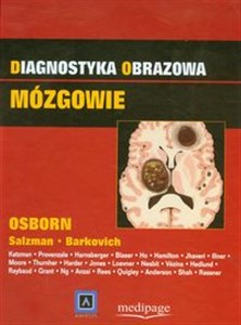 Bild von Diagnostyka obrazowa Mózgowie