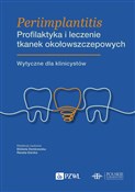 Periimplan... - Elżbieta Dembowska, Renata Górska - buch auf polnisch 