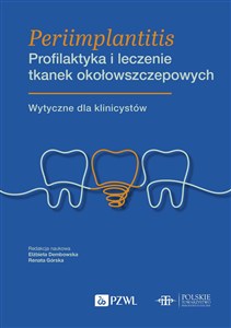 Obrazek Periimplantitis Profilaktyka i leczenie tkanek okołowszczepowych