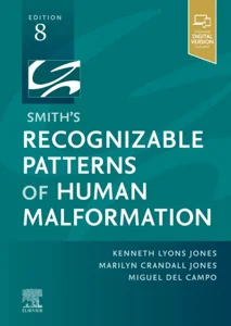 Obrazek Smith's Recognizable Patterns of Human Malformation