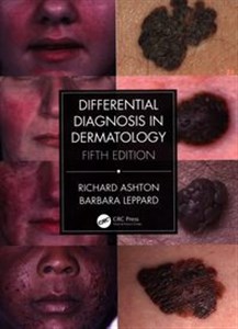 Bild von Differential Diagnosis in Dermatology