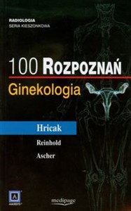 Bild von 100 rozpoznań Ginekologia