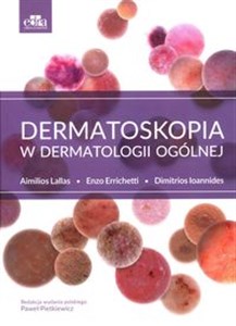 Bild von Dermatoskopia w dermatologii ogólnej