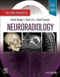 Bild von Neuroradiology. The Core Requisites