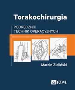 Bild von Torakochirurgia Podręcznik technik operacyjnych