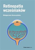 Retinopati... - Małgorzata Seroczyńska -  Polnische Buchandlung 