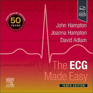Bild von The ECG Made Easy