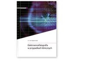 Obrazek Elektroencefalografia w przypadkach klinicznych