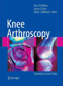 Obrazek KNEE ARTHROSCOPY