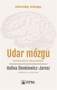 Bild von Udar mózgu Kompendium dla praktyka