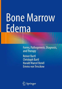 Bild von Bone Marrow Edema. Forms, Pathogenesis, Diagnosis, and Therapy