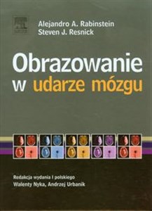 Obrazek Obrazowanie w udarze mózgu