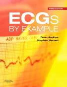 Ecgs By Ex... - Dean Jenkins, Stephen John Gerred - Ksiegarnia w niemczech