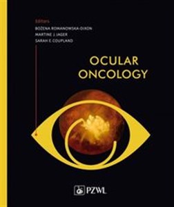 Bild von Ocular oncology