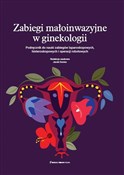 Polnische buch : Zabiegi ma... - Jacek Doniec