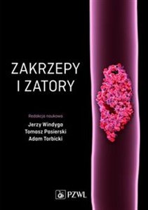 Bild von Zakrzepy i zatory