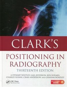Bild von Clarks Positioning in radiography