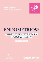 ENDOMETRIO... -  Książka z wysyłką do Niemiec 
