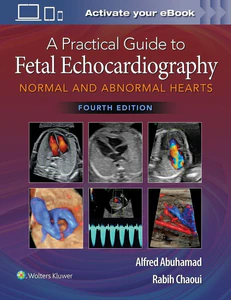 Obrazek A Practical Guide to Fetal Echocardiography