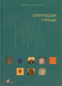 Obrazek Dermatologia cyfrowa